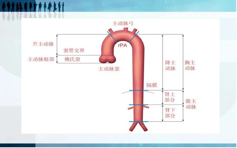 主动脉夹层影像学分析[共36页]_第3页