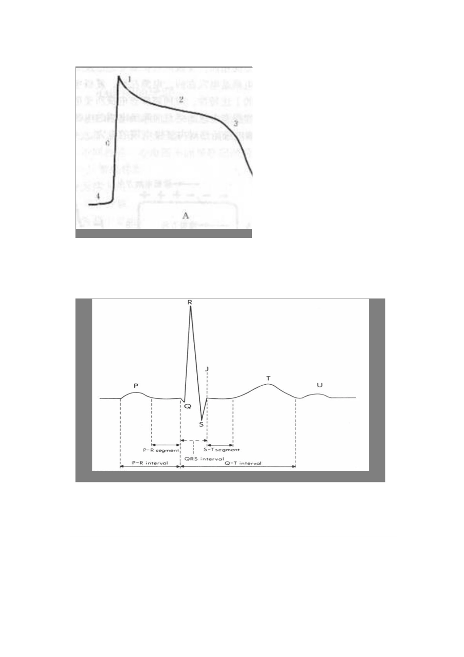 心电图产生原理详解_第3页