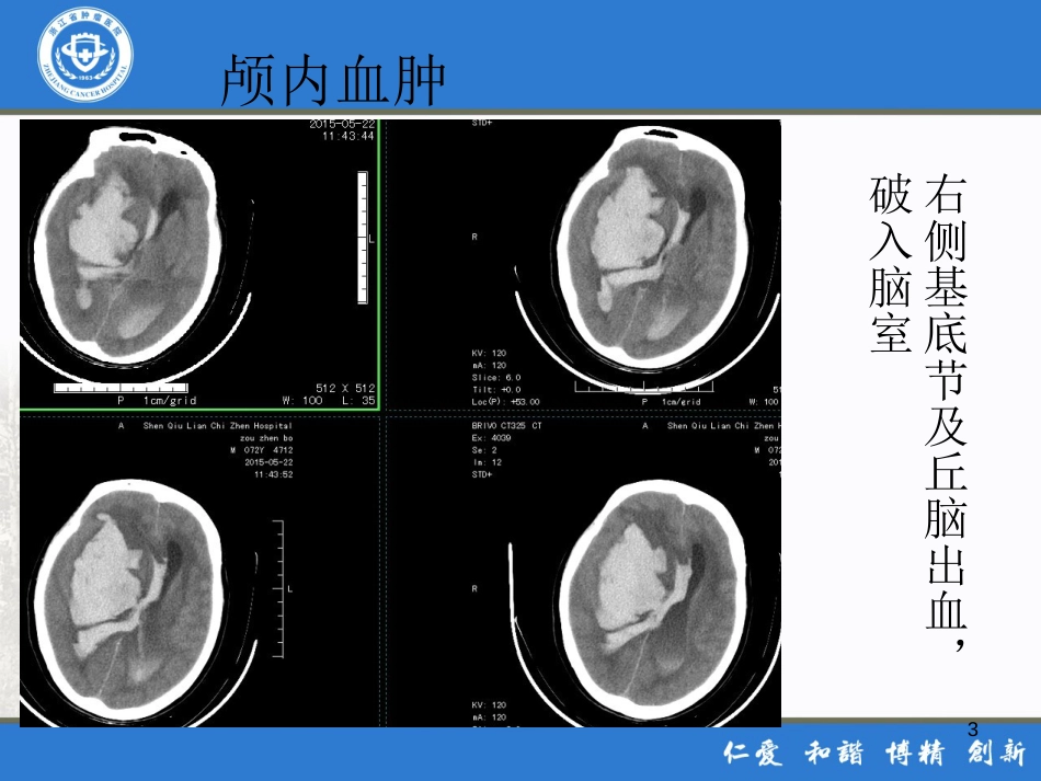 危急值放射科[共74页]_第3页