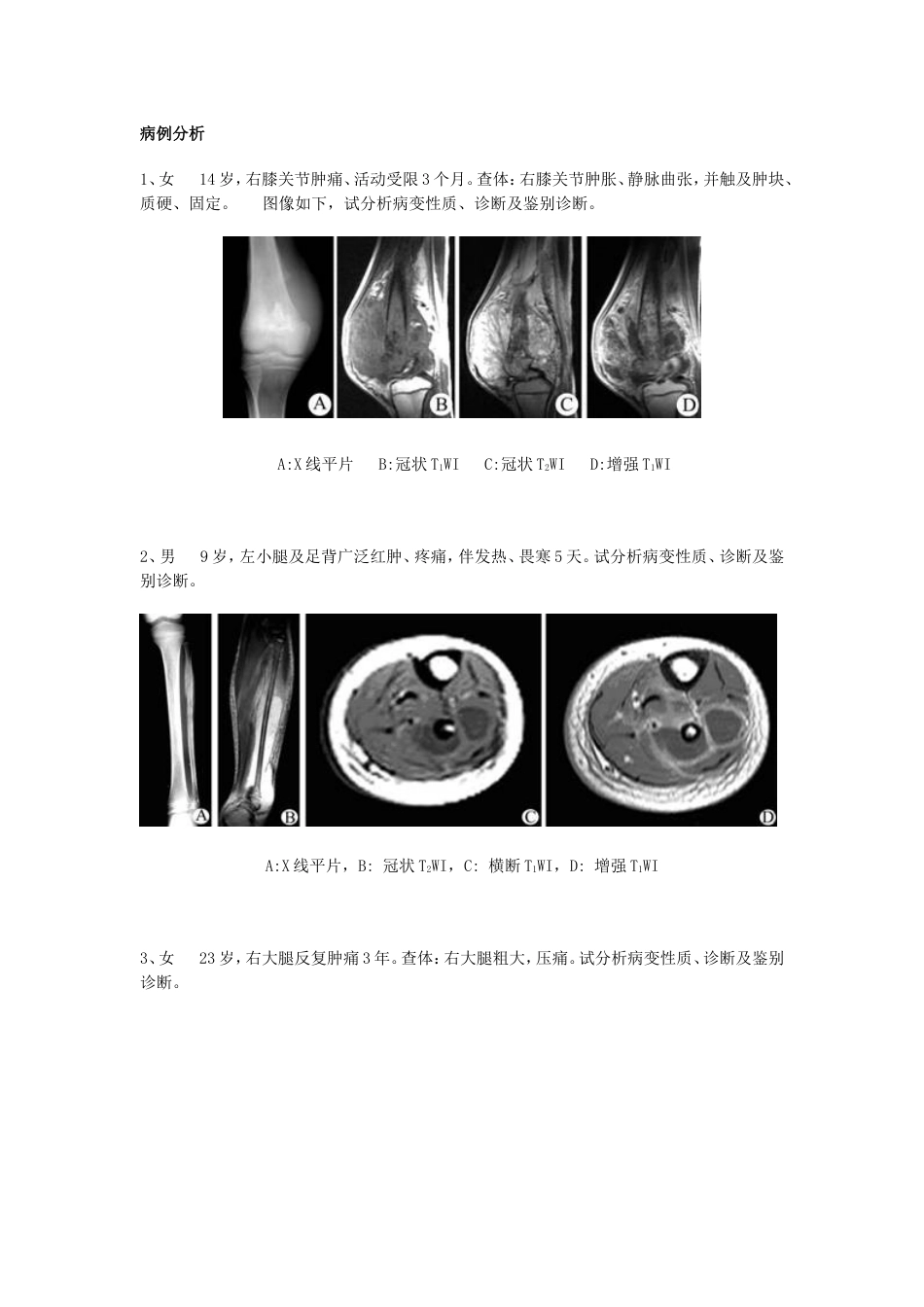 医学影像学病例分析[共35页]_第1页