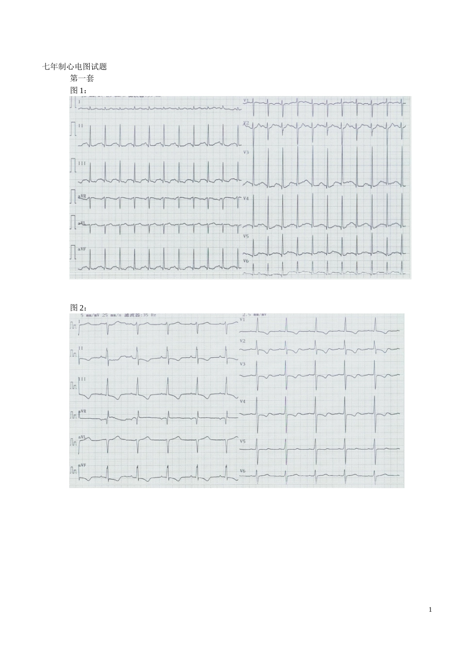心电图试题及标准答案[共15页]_第1页