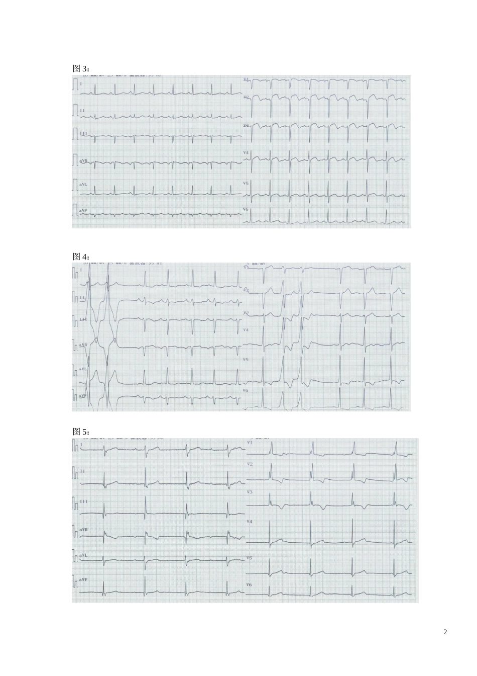心电图试题及标准答案[共15页]_第2页