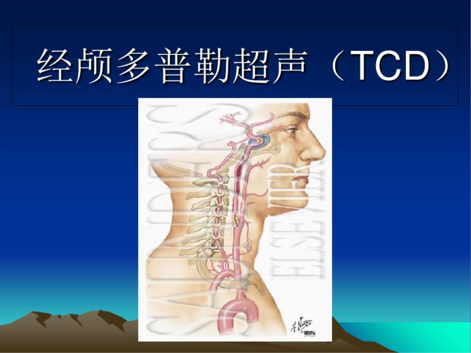 经颅多普勒超声TCD_第1页