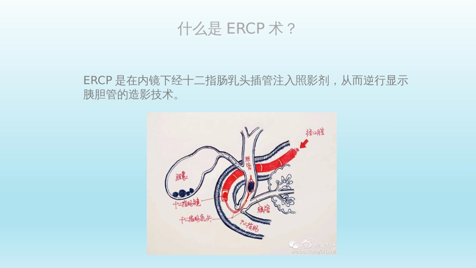 ERCP的术后护理[共17页]_第2页