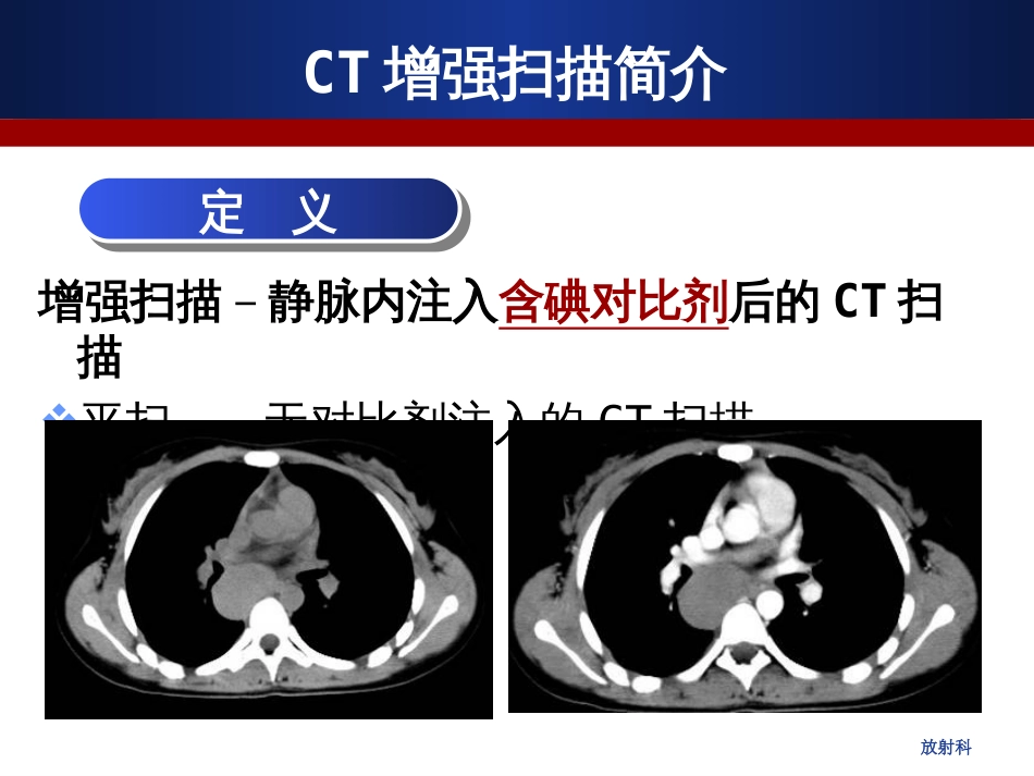 CT增强扫描的临床应用[优质ppt][共61页]_第3页