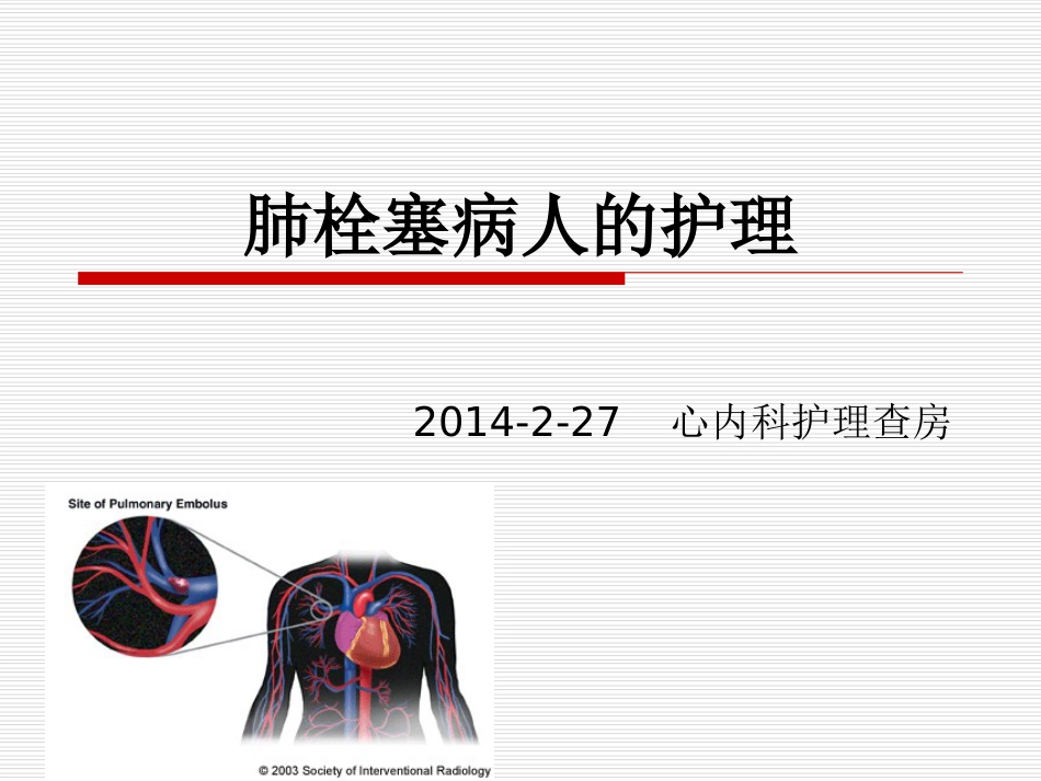 肺栓塞病人的护理查房[共41页]_第1页