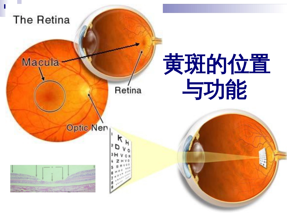 黄斑疾病简版[共24页]_第2页