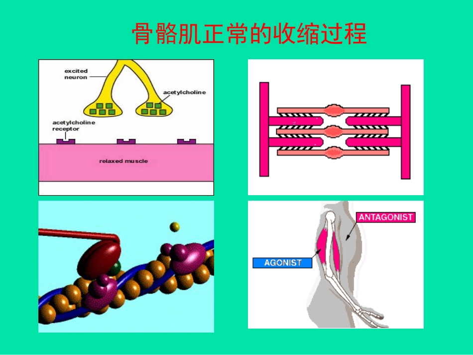 肌松药的临床应用[共75页]_第3页