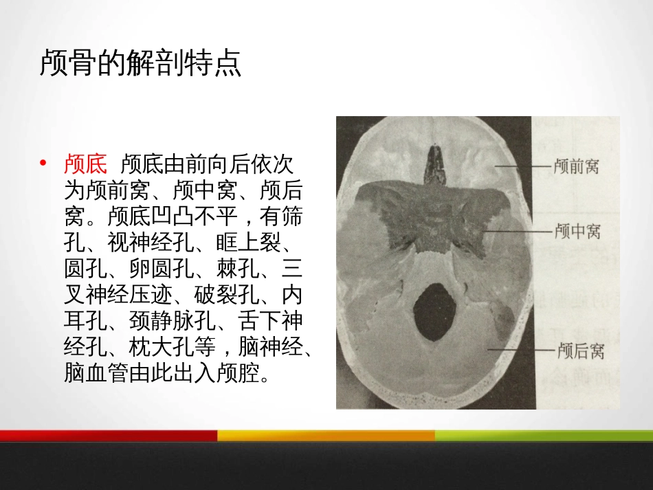 颅骨骨折[共27页]_第3页