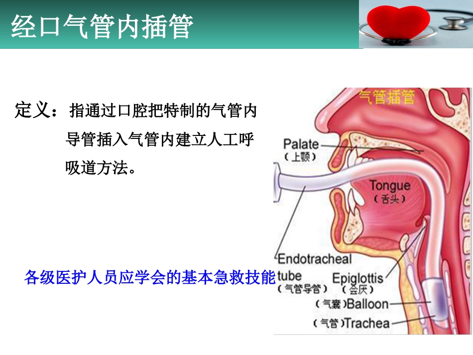 经口气管内插管[共35页]_第2页