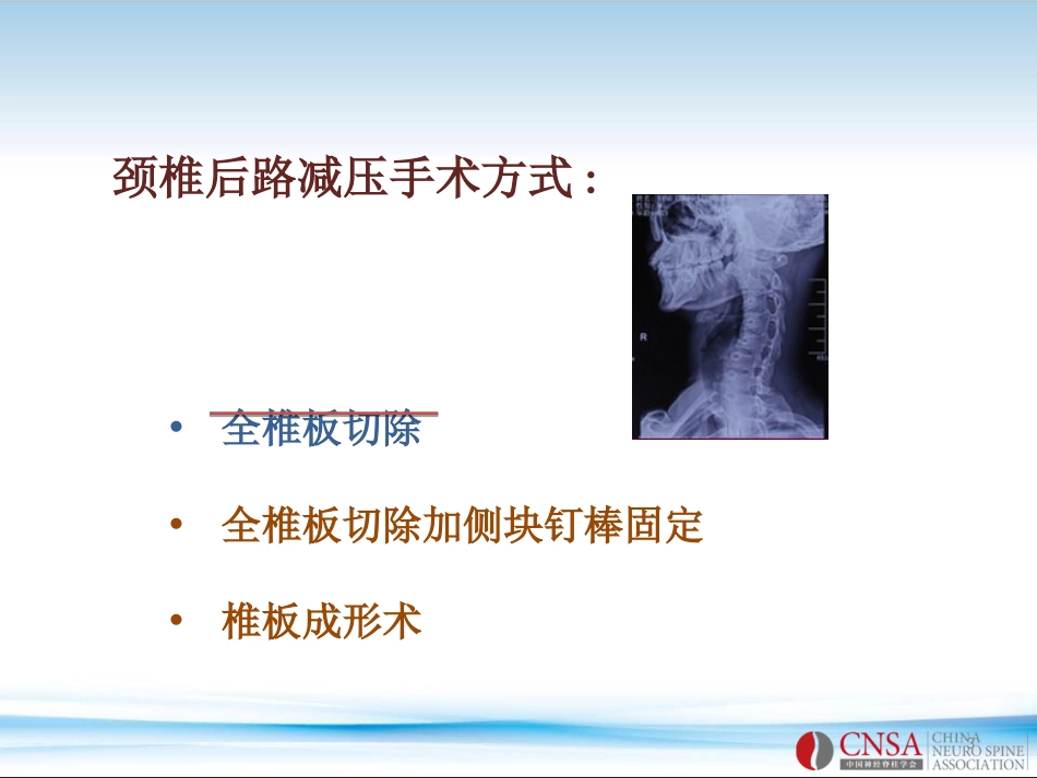 颈椎后路减压术式及特点PPT参考幻灯片_第3页