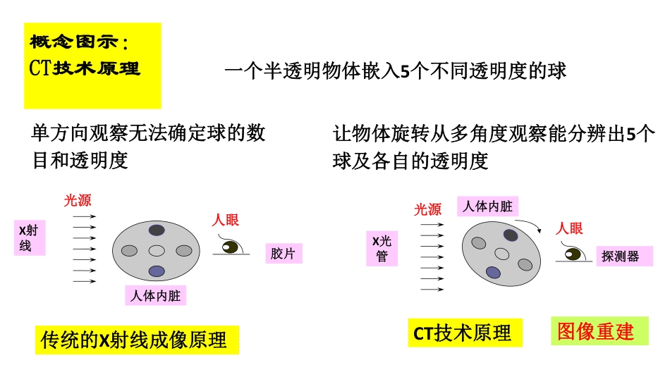 (29)--第四讲 CT技术与图像重建（基本原理）_第3页