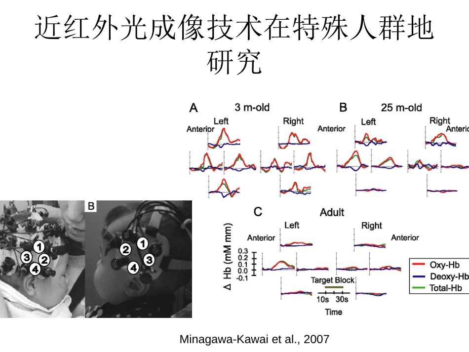 (27)--11.2近红外光成像技术在心理学研究中的运用_第3页