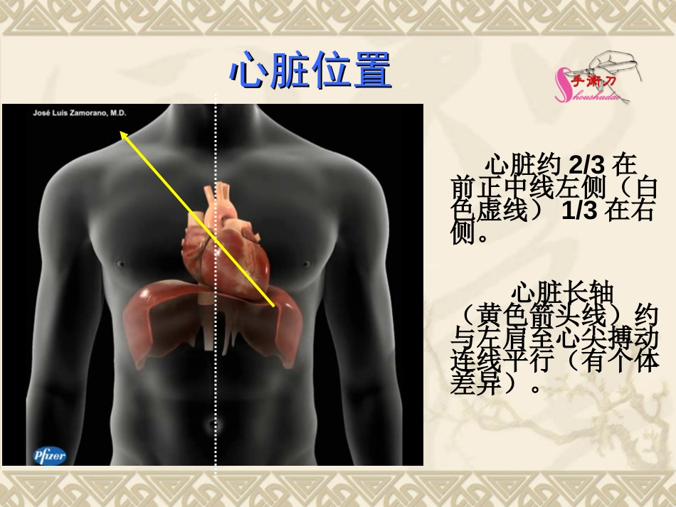 超声心动图常用切面的打法图解_第2页