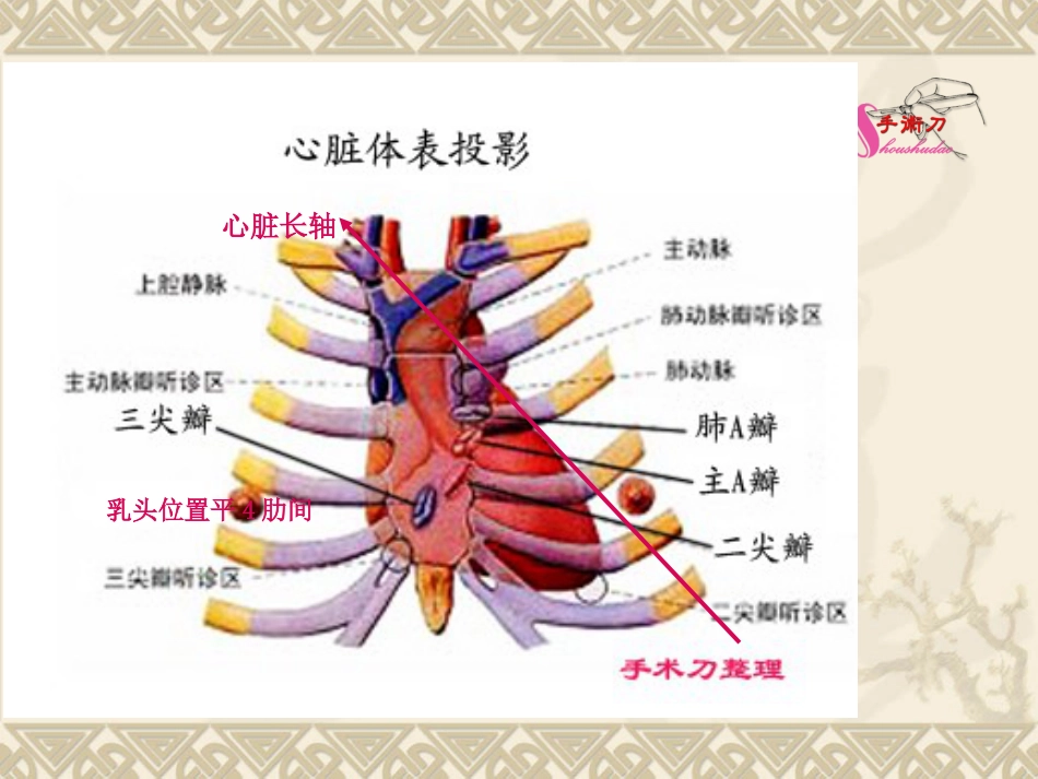 超声心动图常用切面的打法图解_第3页