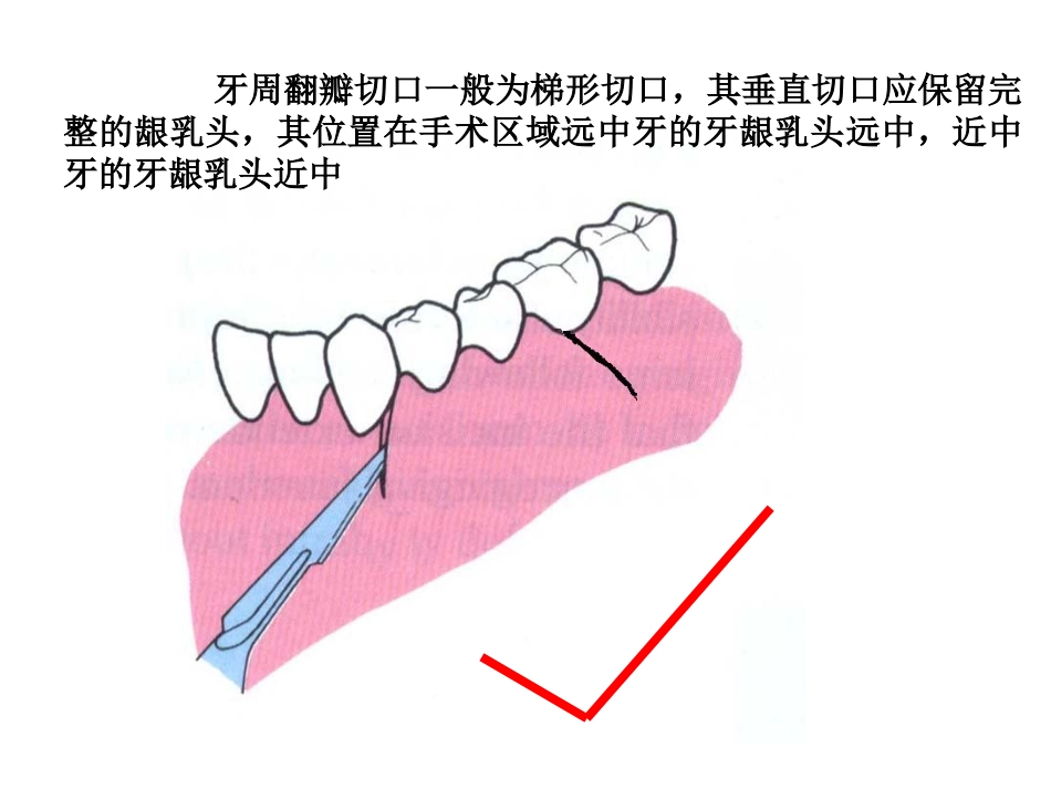 3_牙周外科手术-基本技术_第3页